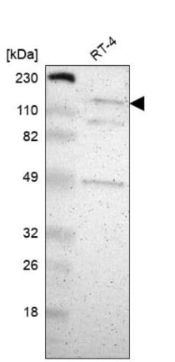 CECR2 Antibody, Novus Biologicals 0.1mL; Unlabeled:Antibodies, Polyclonal